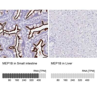 Immunohistochemistry-Paraffin: Meprin beta Subunit/MEP1B Antibody [NBP2-37865]