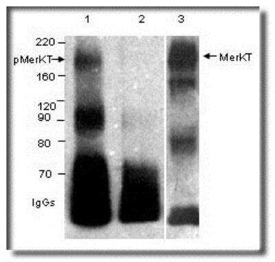 Western Blot: Mer [p Tyr754, p Tyr749, p Tyr753] Antibody [NB300-690]