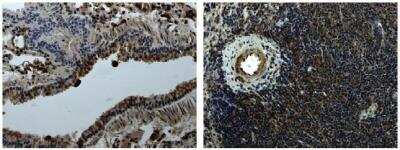 Immunohistochemistry-Paraffin: Mer Antibody (3D07) - Azide and BSA Free [NB110-94148]