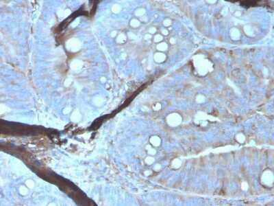 Immunohistochemistry-Paraffin: Mer Antibody (MERTK/3023) [NBP3-13838]