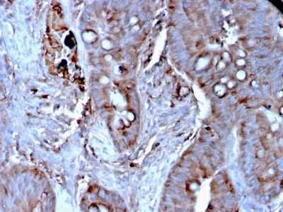 Immunohistochemistry-Paraffin: Mer Antibody (MERTK/3024) [NBP3-13839]