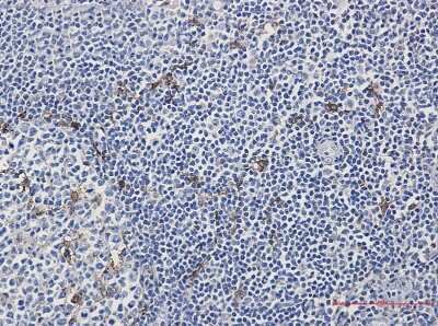 Immunohistochemistry-Paraffin: Mer Antibody (S07-6H2) [NBP3-14954]