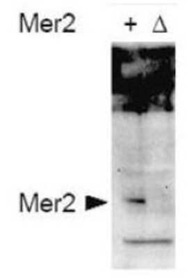 Western Blot: Mer2 [p Ser30] Antibody [NBP1-77754]