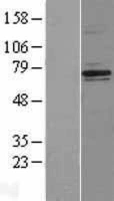 Western Blot: NF2/Merlin Overexpression Lysate [NBL1-13605]