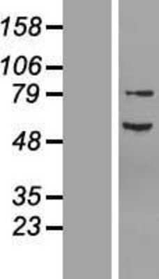 Western Blot: NF2/Merlin Overexpression Lysate [NBL1-13606]