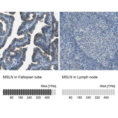 Immunohistochemistry-Paraffin: Mesothelin Antibody [NBP1-88224]