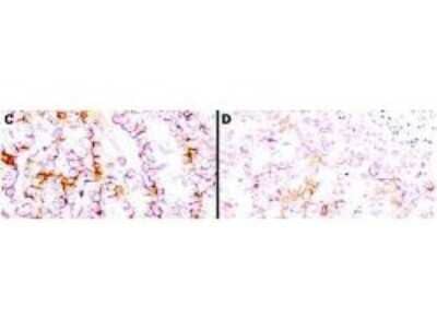 Immunohistochemistry: Mesothelin Antibody (MB-G10) [NB110-85538]