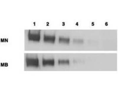 Western Blot: Mesothelin Antibody (MB-G10) [NB110-85538]