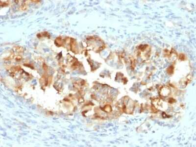 Immunohistochemistry-Paraffin: Mesothelin Antibody (MSLN/2131) - Azide and BSA Free [NBP2-79858]