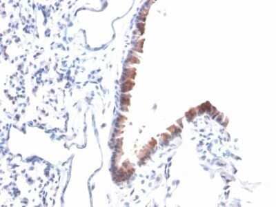Immunohistochemistry-Paraffin: Mesothelin Antibody (MSLN/2131) - Azide and BSA Free [NBP2-79858]