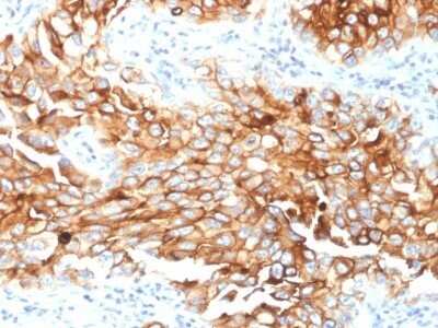 Immunohistochemistry-Paraffin: Mesothelin Antibody (MSLN/2131) - Azide and BSA Free [NBP2-79858]