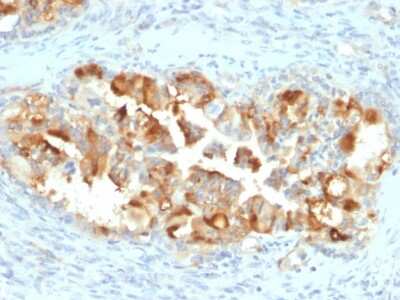 Immunohistochemistry-Paraffin: Mesothelin Antibody (MSLN/2131) [NBP2-79724]