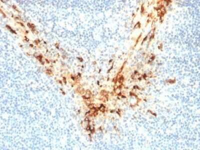 Immunohistochemistry-Paraffin: Mesothelin Antibody (MSLN/2131) [NBP2-79724]