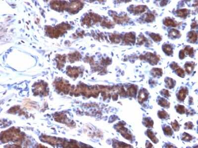 Immunohistochemistry-Paraffin: Mesothelin Antibody (MSLN/2131) [NBP2-79724]