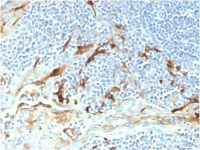 Immunohistochemistry-Paraffin: Mesothelin Antibody (MSLN/2131) [NBP2-79724]