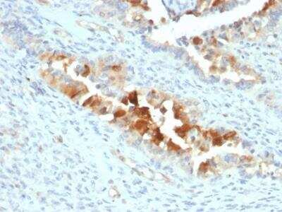 Immunohistochemistry-Paraffin: Mesothelin Antibody (SPM143) [NBP3-09172]