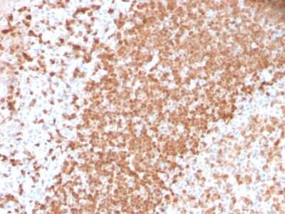 Immunohistochemistry-Paraffin: TCL1A Antibody (TCL1/2747R) - Azide and BSA Free [NBP3-08384]