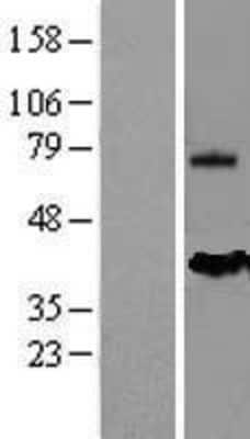 Western Blot: Mesothelin Overexpression Lysate [NBL1-13332]