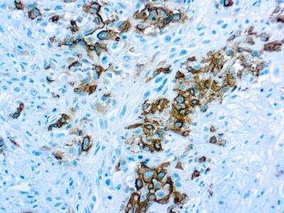 Immunohistochemistry-Paraffin: Mesothelioma Antibody (HBME-1) [NBP1-22828]