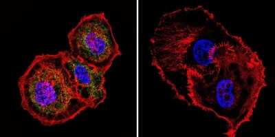 Immunocytochemistry/ Immunofluorescence: Mesothelioma Antibody (ME1) - BSA Free [NBP2-22442]