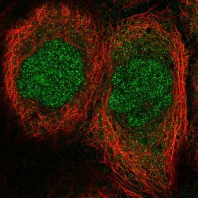 Immunocytochemistry/ Immunofluorescence: Mesp1 Antibody [NBP2-57014]