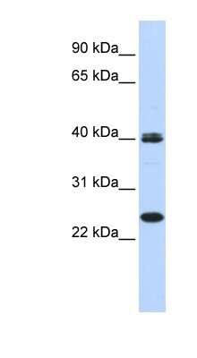 Western Blot: Mesp1 Antibody [NBP1-80342]