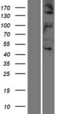 Western Blot: HGFR/c-MET Overexpression Lysate [NBL1-13017]