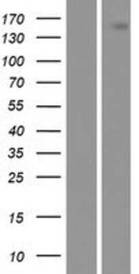 Western Blot: HGFR/c-MET Overexpression Lysate [NBP2-11373]