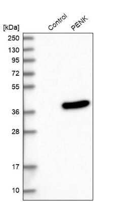 Western Blot: Met-enkephalin Antibody [NBP1-90944]