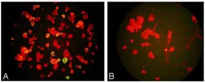 Immunocytochemistry/ Immunofluorescence: Meta-Pneumovirus Antibody (HMPV123) - BSA Free [NBP1-21631]