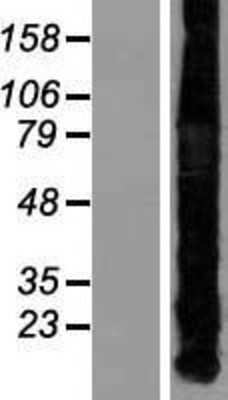 Western Blot: Metallothionein-1A Overexpression Lysate [NBL1-13343]