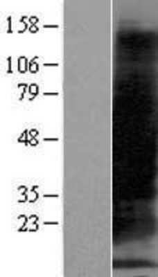 Western Blot: Metallothionein-1B Overexpression Lysate [NBP2-10437]