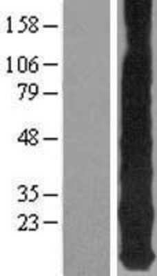 Western Blot: Metallothionein-1E Overexpression Lysate [NBP2-05063]