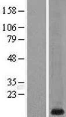 Western Blot: Metallothionein-1G Overexpression Lysate [NBL1-13345]