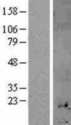 Western Blot: Metallothionein-1H Overexpression Lysate [NBL1-13346]