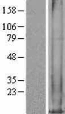 Western Blot: Metallothionein-1M Overexpression Lysate [NBL1-13347]