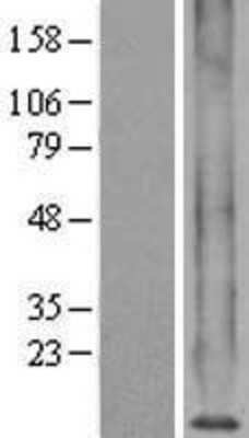 Western Blot: Metallothionein-1X Overexpression Lysate [NBL1-13348]