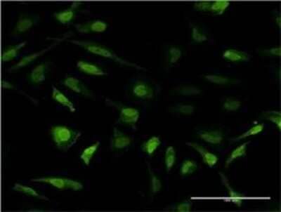 Immunocytochemistry/ Immunofluorescence: Metallothionein-2A Antibody (6G2) [H00004502-M01]