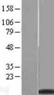 Western Blot: Metallothionein-2A Overexpression Lysate [NBL1-13349]