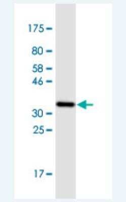 Western Blot: Metallothionein-3 Antibody (1F11) [H00004504-M02-100ug]