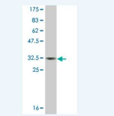 Western Blot: Metallothionein-3 Antibody (3E8) [H00004504-M01A]