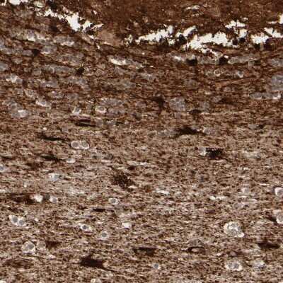 Immunohistochemistry-Paraffin: Metallothionein-3 Antibody [NBP1-89772]