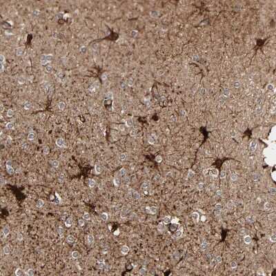 Immunohistochemistry-Paraffin: Metallothionein-3 Antibody [NBP1-89772]