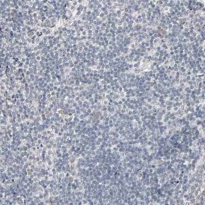 Immunohistochemistry-Paraffin: Metallothionein-3 Antibody [NBP1-89772]
