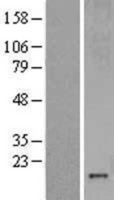 Western Blot: Metallothionein-3 Overexpression Lysate [NBL1-13350]