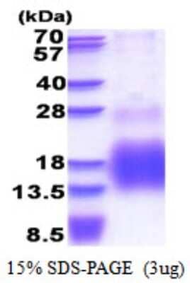 SDS-PAGE: Recombinant Human Metallothionein-3 His Protein [NBP2-51551]