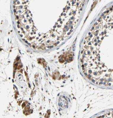 Immunohistochemistry-Paraffin: Metaxin 1 Antibody [NBP1-87741]