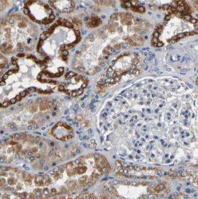 Immunohistochemistry-Paraffin: Metaxin 1 Antibody [NBP1-87741]