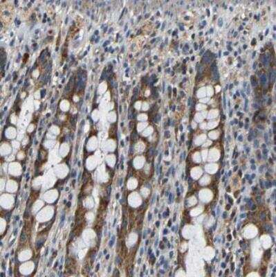 Immunohistochemistry-Paraffin: Metaxin 1 Antibody [NBP1-87741]