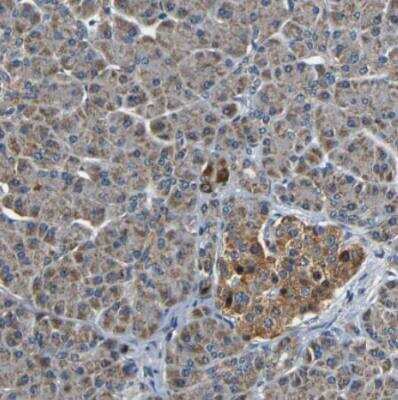Immunohistochemistry-Paraffin: Metaxin 1 Antibody [NBP1-87741]